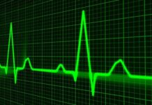 Smart Watch should help in case of cardiac arrest